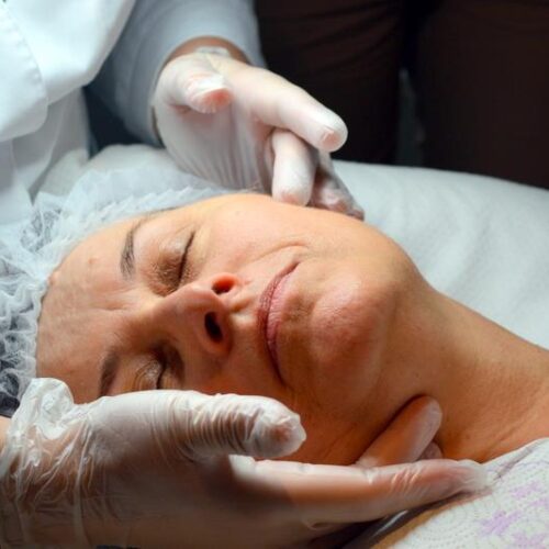 Iniciación ácidos y peelings profesionales. Academia para profesionales de la estética online.