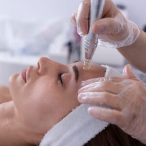 Ácidos, Exosomas y Microneedling en Peelings Profesionales